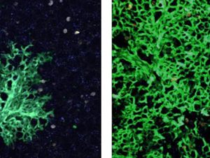 New lung cells are continuously created to replace the damaged ones: Lung tissue six weeks after stem cell transplantation (left) and 16 weeks after transplantation (right). Cells that originated in the transplanted stem cells are green, as opposed to the uncolored host lung cells. Photon-2 microscope image. CREDIT: Weizmann Institute of Science