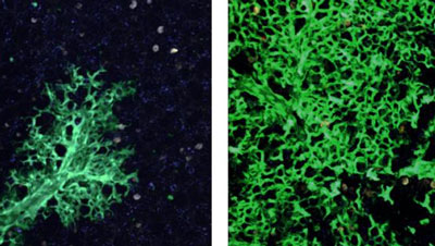 New lung cells are continuously created to replace the damaged ones: Lung tissue six weeks after stem cell transplantation (left) and 16 weeks after transplantation (right). Cells that originated in the transplanted stem cells are green, as opposed to the uncolored host lung cells. Photon-2 microscope image. CREDIT: Weizmann Institute of Science