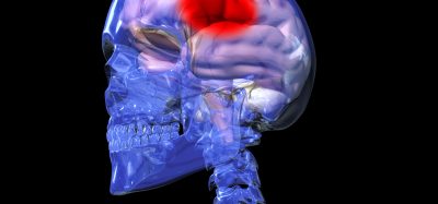 Skull with faded blue outline with a pink brain inside with large red spot