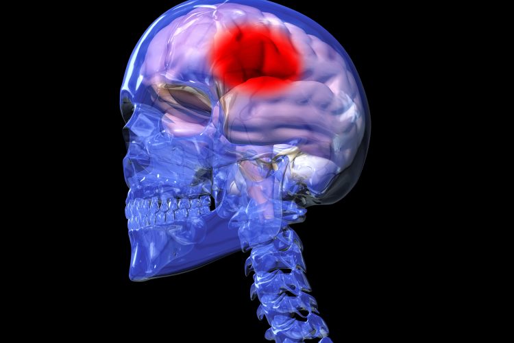 Skull with faded blue outline with a pink brain inside with large red spot