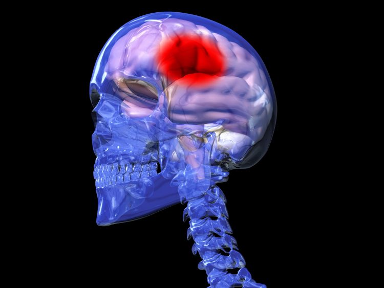 Skull with faded blue outline with a pink brain inside with large red spot