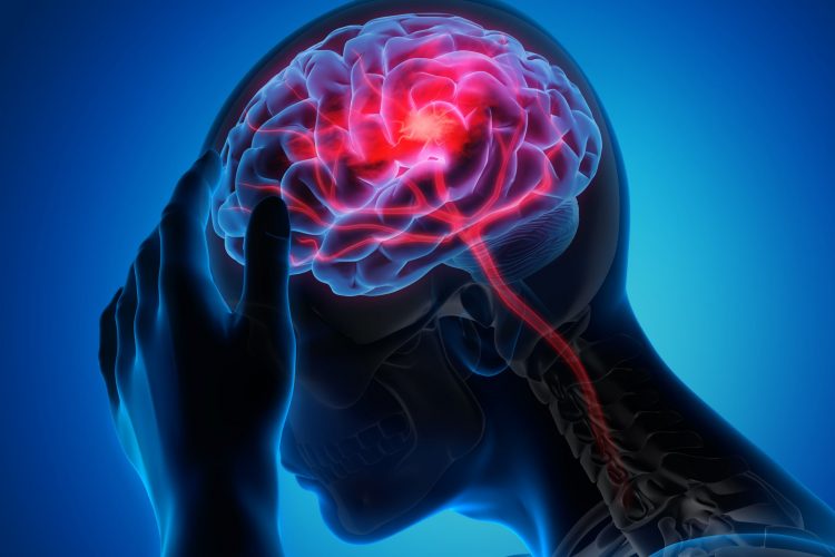 man holding head due to headache/stroke, with brain visible