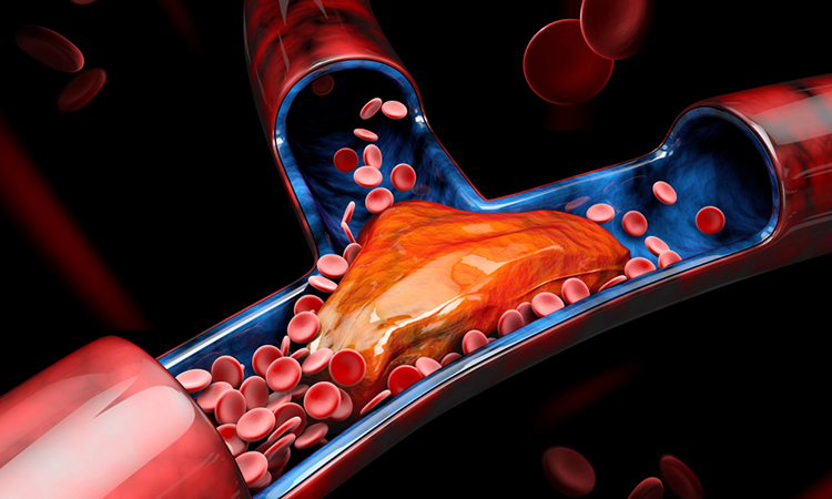 organ-on-a-chip-thrombosis