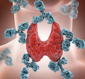 thyroid