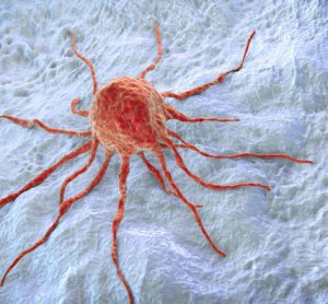 cancer cells