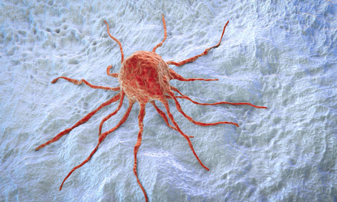 cancer cells