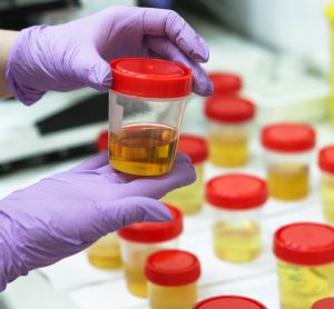 researcher examining potted urine samples