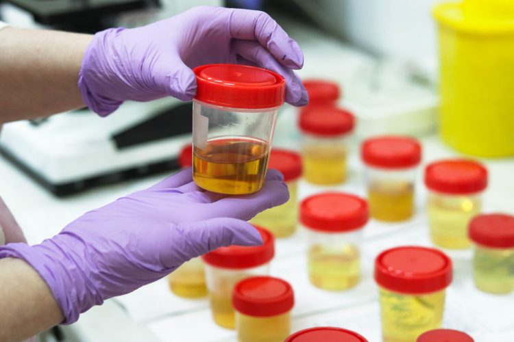 researcher examining potted urine samples